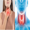 Thyroid, Symptoms