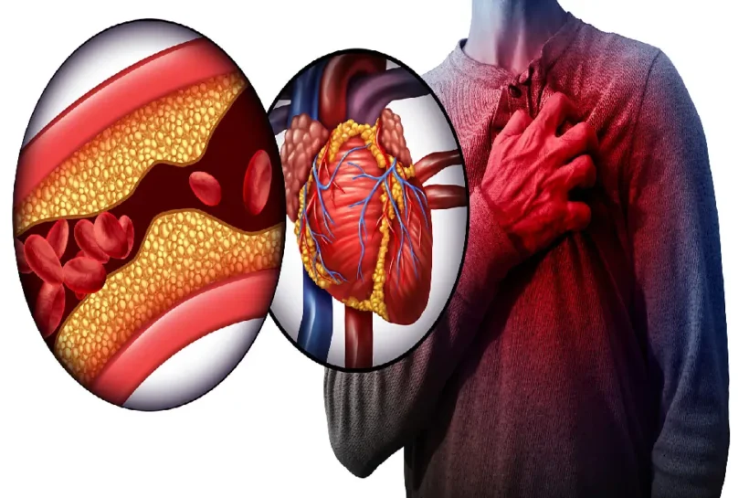 Heart attack symptoms