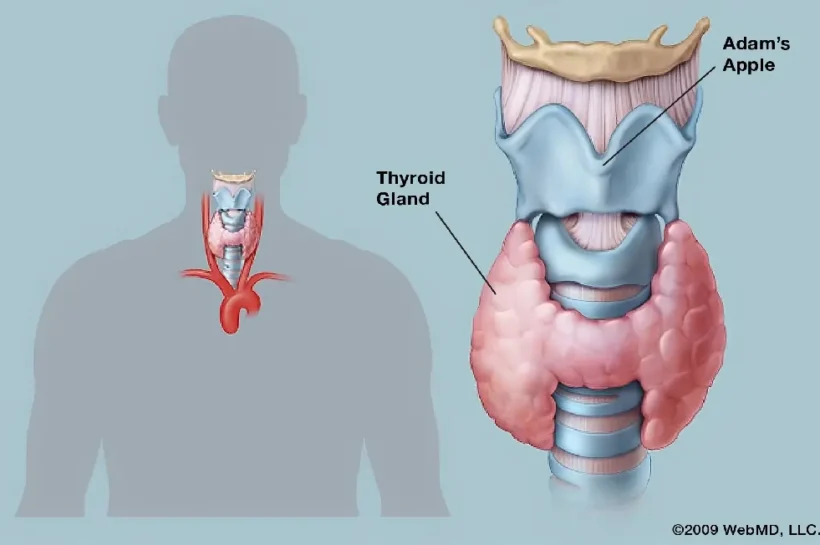Thyroid Disorder, Thyroid Disorder treatment