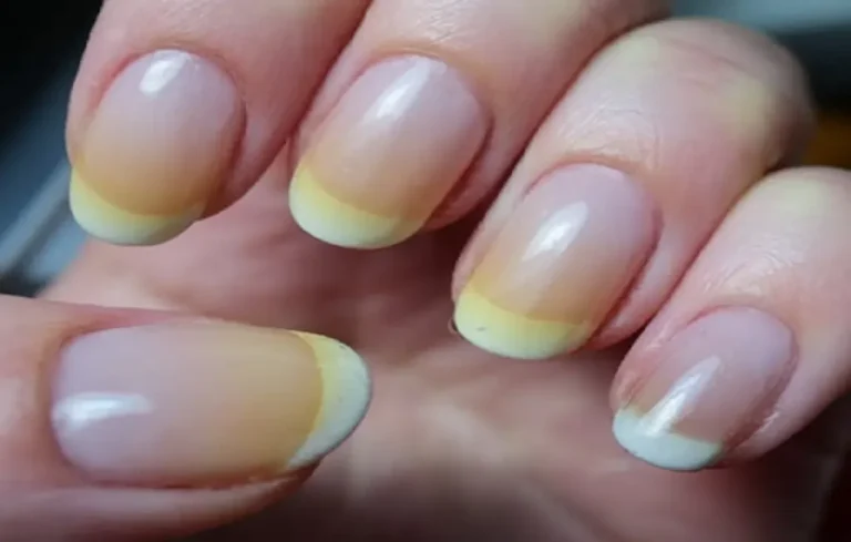 Yellow Nails, Yellow Nails issue