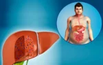 Liver Care Tips
