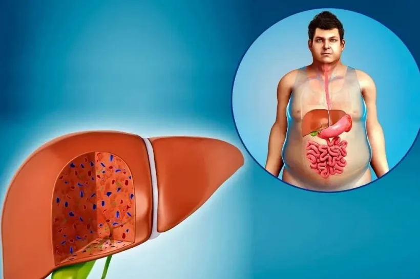 Liver Care Tips