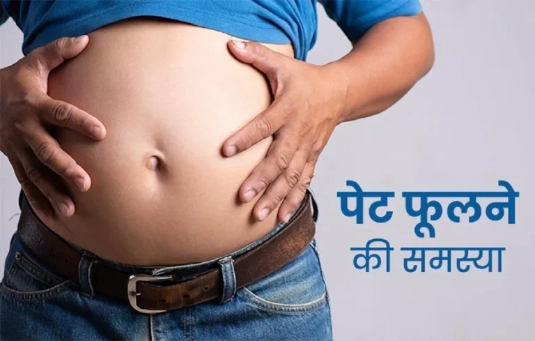 पेट फूलने को गैस समझना पड़ सकता है भारी, आगरा में बढ़े एसाइटिस के मरीज; डॉक्टर ने दी चेतावनी| Agra health news Agra health news